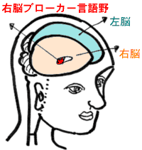 あなたにもできる心の地図づくり　あなたの問題の所在は「右脳・聴覚野」にあります。