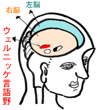 あなたにもできる心の理解術　問題の所在は「ウェルニッケ」（触覚の認知）にあります。