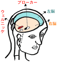 あなたにもできる心の愛情術 問題の所在は「右脳」ウェルニッケとブローカーにあります。