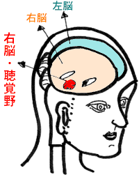 あなたにもできる心の診断術
あなたの問題の所在は、「右脳・聴覚野」にあります。